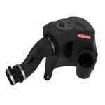 aFe Takeda Momentum Pro Dry S cold air intake system with black sealed housing, clear sight window, and air filter.